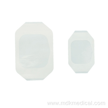 Sterile IV Cannula Fixation (Wound Dressing)